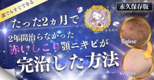 【真似するだけ】たった2ヵ月で、2年間治らなかった赤いしこり顎ニキビが完治した方法